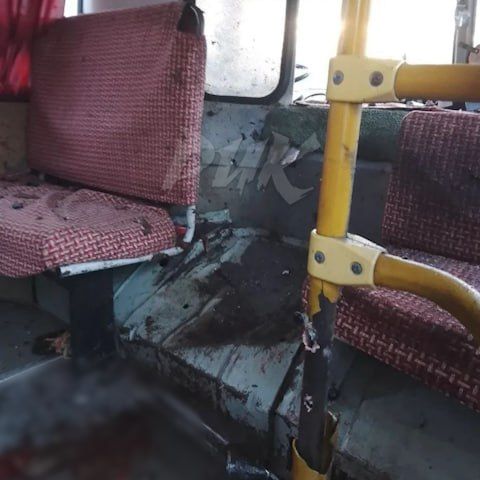 Хирургу второй больницы в Горловке оторвало руку и ногу в результате удара БПЛА по автобусу №2 в жилом массиве "Комсомолец" Никитовского района